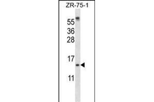 SUMO1 Antibody (N-term) (ABIN657634 and ABIN2846630) western blot analysis in ZR-75-1 cell line lysates (35 μg/lane). (SUMO1 抗体  (N-Term))
