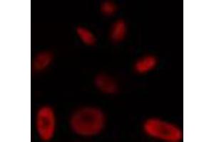 ABIN6272448 staining HT29 by IF/ICC. (Protein Tob1 (TOB1) (Internal Region) 抗体)