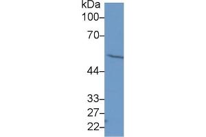 Western Blot; Sample: Human Hela cell lysate; Primary Ab: 1µg/ml Rabbit Anti-Human FSCN Antibody Second Ab: 0. (Fascin 抗体  (AA 277-396))