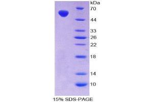 SDS-PAGE (SDS) image for V-Fos FBJ Murine Osteosarcoma Viral Oncogene Homolog (FOS) (AA 6-240) protein (His tag,GST tag) (ABIN2123735) (FOS Protein (AA 6-240) (His tag,GST tag))