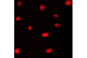 Immunofluorescence (IF) image for anti-Apoptosis Antagonizing Transcription Factor (AATF) (N-Term) antibody (ABIN7298044)