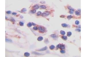 Image no. 1 for anti-Transforming Growth Factor, beta 1 (TGFB1) antibody (ABIN465317) (TGFB1 抗体)