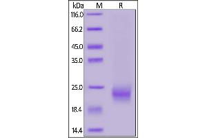 Biotinylated Human IL-5, His,Avitag on  under reducing (R) condition. (IL-5 Protein (AA 20-134) (His tag,AVI tag,Biotin))