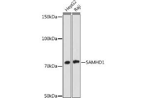 Western blot analysis of extracts of various cell lines, using S antibody (ABIN7270142) at 1:1000 dilution. (SAMHD1 抗体)