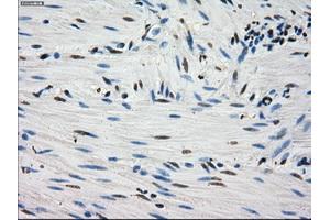 Immunohistochemical staining of paraffin-embedded Kidney tissue using anti-FHmouse monoclonal antibody. (FH 抗体)