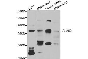 Western blot analysis of extracts of various cell lines, using ALAS2 antibody (ABIN5973907) at 1/1000 dilution. (ALAS2 抗体)