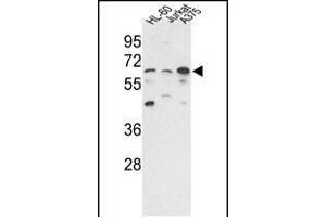 Western blot analysis of hP3CC-E33 (ABIN392895 and ABIN2837849) in HL-60, Jurkat,  cell line lysates (35 μg/lane). (PPP3CC 抗体  (N-Term))