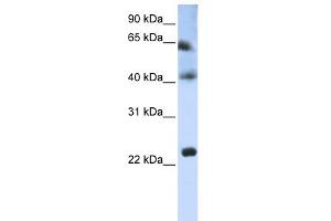 WB Suggested Anti-TSPAN3 Antibody Titration:  0. (Tetraspanin 3 抗体  (Middle Region))