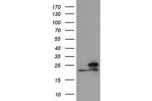 Image no. 1 for anti-NADH Dehydrogenase (Ubiquinone) 1 beta Subcomplex, 10, 22kDa (NDUFB10) antibody (ABIN1499670)