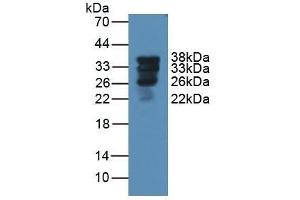Detection of SFTPA1 in Rat Lung Tissue using Polyclonal Antibody to Pulmonary Surfactant Associated Protein A1 (SFTPA1) (Surfactant Protein A1 抗体  (AA 21-248))