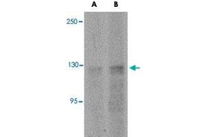 Western blot analysis of ANO2 in rat brain tissue lysate with ANO2 polyclonal antibody  at (A) 1 and (B) 2 ug/mL . (Anoctamin 2 抗体  (N-Term))
