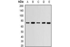 Western blot analysis of RBBP5 expression in MCF7 (A), Hela (B), mouse spleen (C), mouse brain (D), rat liver (E) whole cell lysates. (RBBP5 抗体)