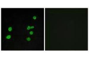 Immunofluorescence analysis of MCF-7 cells, using p97 MAPK antibody. (MAPK6 抗体)