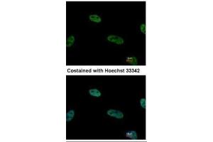 ICC/IF Image Immunofluorescence analysis of paraformaldehyde-fixed HeLa, using TRIP15, antibody at 1:500 dilution. (COPS2 抗体  (C-Term))