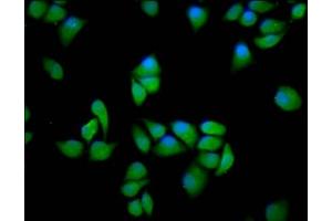 Immunofluorescence staining of Hela cells with ABIN7169254 at 1:166, counter-stained with DAPI. (PPP2R5E 抗体  (Regulatory Subunit))
