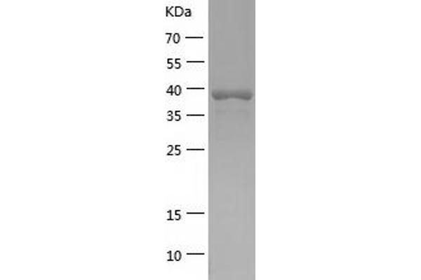 NCK1 Protein (AA 1-377) (His tag)
