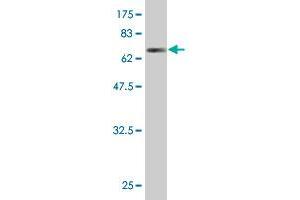 Western Blot detection against Immunogen (67. (GPD2 抗体  (AA 1-378))