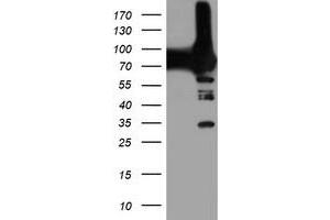 Western Blotting (WB) image for anti-phosphofructokinase, Platelet (PFKP) antibody (ABIN1500166) (PFKP 抗体)