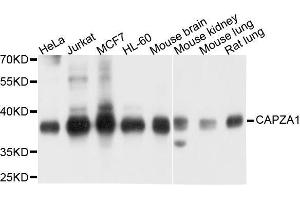 Western blot analysis of extracts of various cell lines, using CAPZA1 antibody. (CAPZA1 抗体  (AA 1-286))