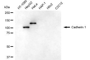 Western blotting analysis using cadherin 1 antibody (ABIN7797818).