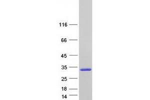 Western Blotting (WB) image for N-Acetyltransferase 15 (NAT15) (Transcript Variant 3) protein (Myc-DYKDDDDK Tag) (ABIN2726737)