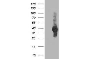 Western Blotting (WB) image for anti-ATG3 Autophagy Related 3 (ATG3) antibody (ABIN1496762) (ATG3 抗体)