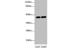 Western blot All lanes: LMNTD1 antibody at 12 μg/mL Lane 1: MCF-7 whole cell lysate Lane 2: Mouse liver tissue Secondary Goat polyclonal to rabbit IgG at 1/10000 dilution Predicted band size: 44, 34, 37, 42, 46 kDa Observed band size: 44 kDa (PAS1C1 抗体  (AA 113-291))