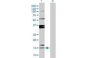 Western Blotting (WB) image for anti-serine Peptidase Inhibitor, Kazal Type 1 (SPINK1) (AA 1-79) antibody (ABIN520431)