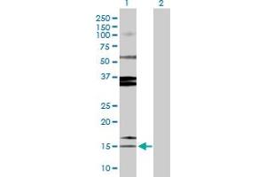 Western Blot analysis of SPINK1 expression in transfected 293T cell line by SPINK1 MaxPab polyclonal antibody. (SPINK1 抗体  (AA 1-79))