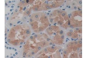DAB staining on IHC-P; Samples: Human Kidney Tissue (ASS1 抗体  (AA 1-412))