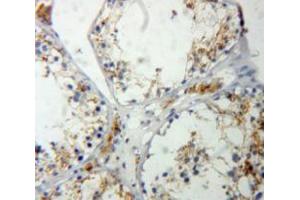 Used in DAB staining on fromalin fixed paraffin-embedded Testis tissue (RASA1 抗体  (AA 403-596))