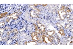 Immunohistochemistry (IHC) image for anti-Slit Homolog 3 (SLIT3) (AA 1405-1512) antibody (ABIN7435490)