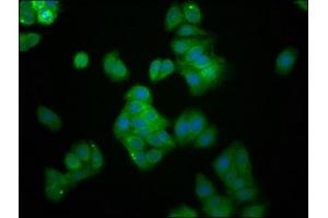 Immunofluorescence staining of HepG2 cells with ABIN7174451 at 1:166, counter-stained with DAPI. (UBE2G1 抗体  (AA 2-170))