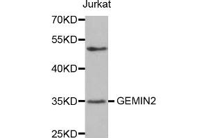 Western blot analysis of extracts of Jurkat cells, using GEMIN2 antibody. (SIP1 抗体)
