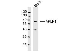 Mouse Brain lysates probed with APLP1 Polyclonal Antibody, Unconjugated  at 1:300 dilution and 4˚C overnight incubation. (APLP1 抗体  (AA 1-100))