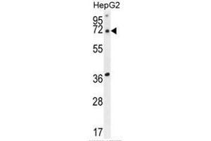 ACOT11 Antibody (C-term) western blot analysis in HepG2 cell line lysates (35 µg/lane). (ACOT11 抗体  (C-Term))