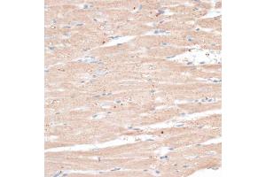 Immunohistochemistry of paraffin-embedded rat heart using ABCB7 antibody. (ABCB7 抗体)
