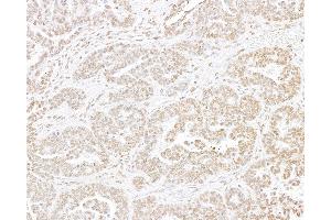 Immunohistochemistry (IHC) image for anti-Histone H3 (H3) (C-Term) antibody (ABIN7455227) (Histone 3 抗体  (C-Term))
