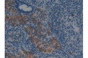 Immunohistochemistry (IHC) image for anti-Glutathione S-Transferase theta 2 (GSTT2) (AA 15-216) antibody (ABIN7432196)