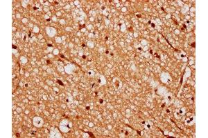 IHC image of ABIN7168370 diluted at 1:300 and staining in paraffin-embedded human brain tissue performed on a Leica BondTM system. (MEX3A 抗体  (AA 416-466))