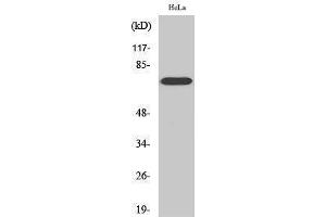 Western Blotting (WB) image for anti-V-Raf-1 Murine Leukemia Viral Oncogene Homolog 1 (RAF1) (Thr56) antibody (ABIN3177115) (RAF1 抗体  (Thr56))
