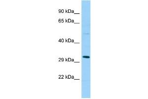 WB Suggested Anti-SPSB1 Antibody Titration: 1.