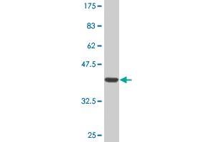 Western Blot detection against Immunogen (36. (RCAN1 抗体  (AA 1-100))