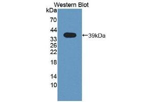 Detection of Recombinant RIPK2, Mouse using Polyclonal Antibody to Receptor Interacting Serine Threonine Kinase 2 (RIPK2) (RIPK2 抗体  (AA 1-294))