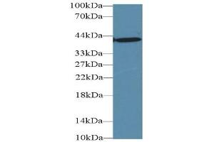 Mouse Capture antibody from the kit in WB with Positive Control: Sample Human liver lysate.