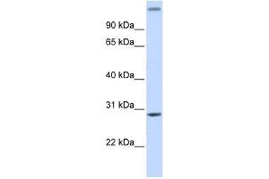 ALKBH2 antibody used at 1 ug/ml to detect target protein. (ALKBH2 抗体)