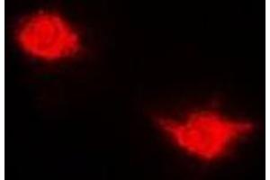 Immunofluorescent analysis of USP7 staining in Hela cells. (USP7 抗体)