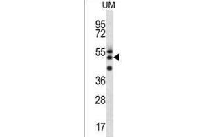 RMD2 Antibody (Center) (ABIN1538003 and ABIN2849325) western blot analysis in uterus tumor cell line lysates (35 μg/lane). (FAM82A1 抗体  (AA 188-216))