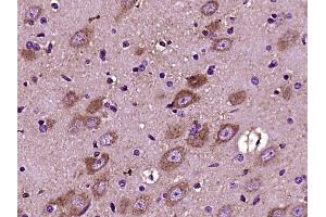 Paraformaldehyde-fixed, paraffin embedded rat brain, Antigen retrieval by boiling in sodium citrate buffer (pH6) for 15min, Block endogenous peroxidase by 3% hydrogen peroxide for 30 minutes, Blocking buffer (normal goat serum) at 37°C for 20min, Antibody incubation with Versican Polyclonal Antibody (bs-2533R) at 1:400 overnight at 4°C, followed by a conjugated secondary and DAB staining (Versican 抗体  (AA 3301-3396))