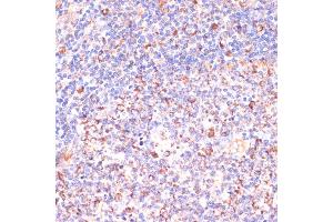 Immunohistochemistry of paraffin-embedded human tonsil using VHL antibody (ABIN3020967, ABIN3020968, ABIN3020969 and ABIN6213828) at dilution of 1:200 (40x lens). (VHL 抗体  (AA 1-172))